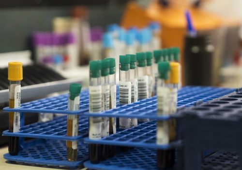 A selective focus shot of test tubes in a tray in the laboratory